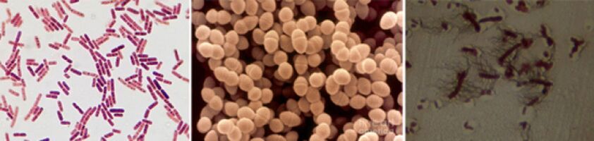 Escherichia Coli, Fecal Enterococcus және Proteus созылмалы бактериялық простатиттің негізгі қоздырғыш агенттері болып табылады